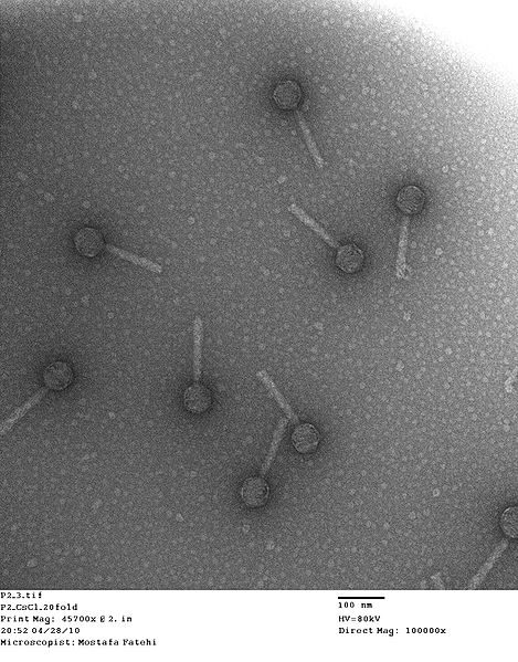 Bacteriophage P2 using Transmission Electron Microscope